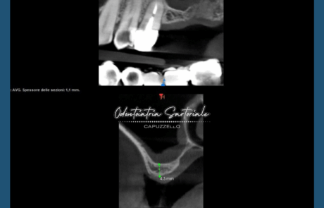 Copia di IG grafica Rubrica Sil Gian Val Sil (1080 x 1350 px) (27)