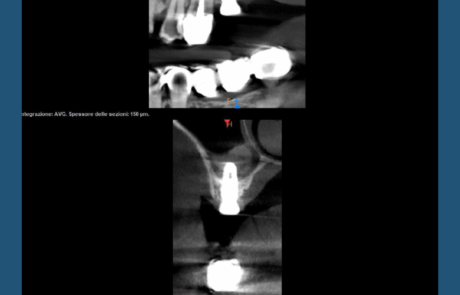 Copia di IG grafica Rubrica Sil Gian Val Sil (1080 x 1350 px) (28)