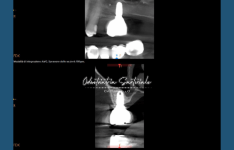 Copia di IG grafica Rubrica Sil Gian Val Sil (1080 x 1350 px) (29)