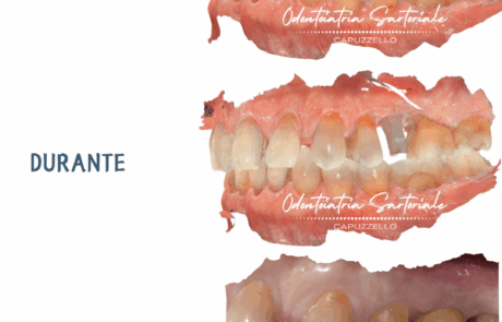 Copia di IG grafica Rubrica Sil Gian Val Sil (1080 x 1350 px) (20)