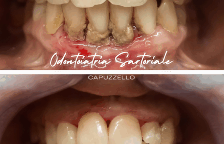 Copia di IG grafica Rubrica Sil Gian Val Sil (1080 x 1350 px) (21)