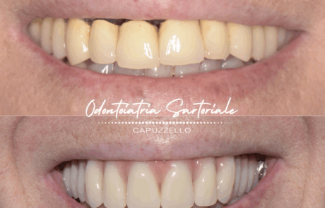 Copia di IG grafica Rubrica Sil Gian Val Sil (1080 x 1350 px) (22)