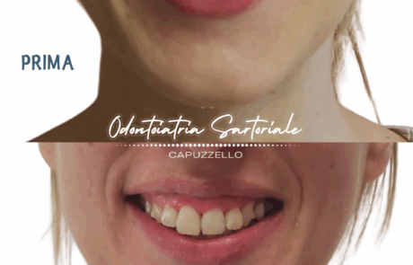 Copia di IG grafica Rubrica Sil Gian Val Sil (1080 x 1350 px) (23)