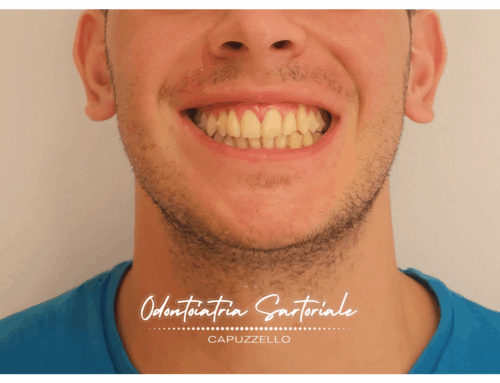 Nuova armonia e funzionalità al sorriso