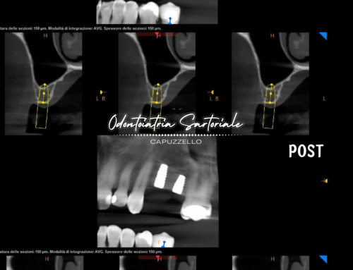 Quando la tecnologia e l’esperienza lavorano insieme