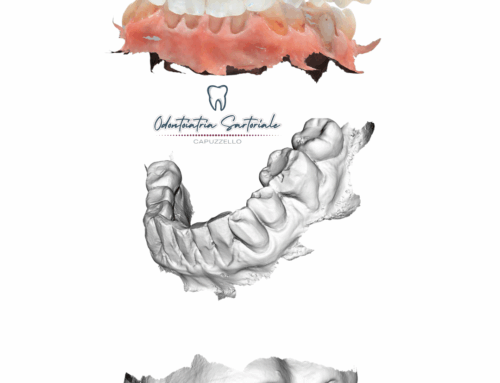 Come nasce il progetto di un sorriso