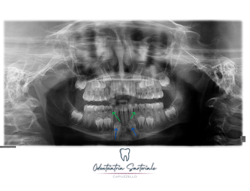 Quando la scelta del giusto approccio non è un caso.
