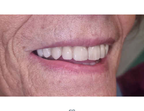 Quando la scelta del giusto approccio non è un caso.