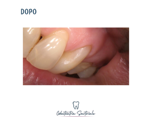 Ogni dettaglio del sorriso ha la sua importanza